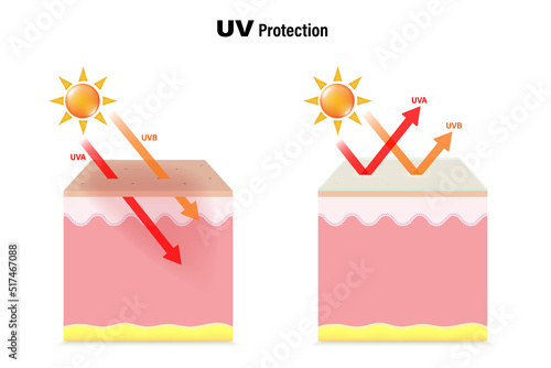 UV Protecttion. The difference between skin without sunscreen lotion and skin with sun protection lotion. photo