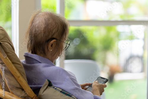 Senior Woman With Hair Loss After Chemotherapy From Breast Cancer Using Smartphone at Home photo
