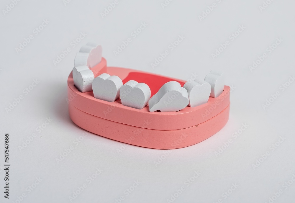 Tooth banner. Jaw model with white teeth with bad unhealthy missing ...