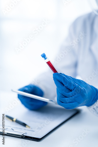 Doctor hand taking a blood sample tube from a rack with machines of analysis in the lab background  Technician holding blood tube test in the research laboratory.