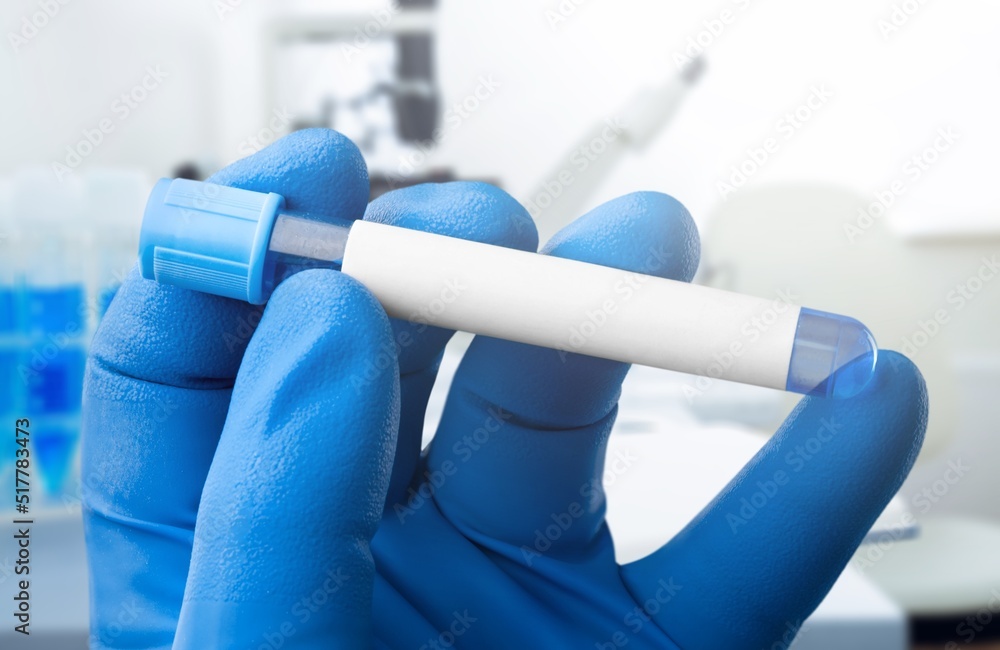 Blood tube test for test. Blood sample tube for analysis of tests in laboratory Blood tube test for test. Blood sample tube for analysis of tests in laboratory