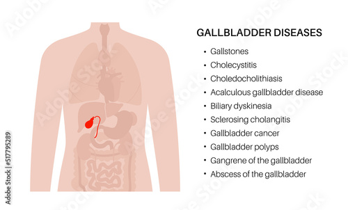 gallbladder anatomy poster