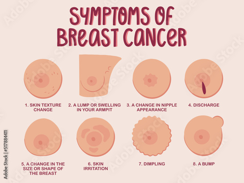 Breast cancer awareness month, medical Infograph illustration with breast cancer symptoms, for disease prevention campaign, flat vector illustration