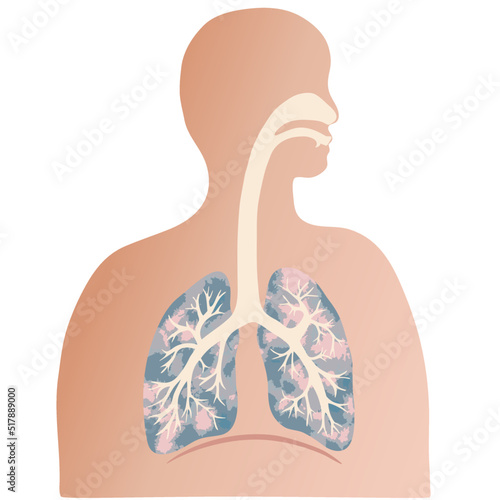 手描きテクスチャのカラフルな肺と気管支のイラストと人のシルエット 
Colorful illustration of the lungs and trachea with human silhouette.