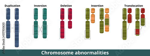 Chromosome abnormalities. Visualization of common chromosomal mutation or disorder. Numerical or structural abnormalities where is a missing, extra, or irregular portion of chromosomal DNA. photo