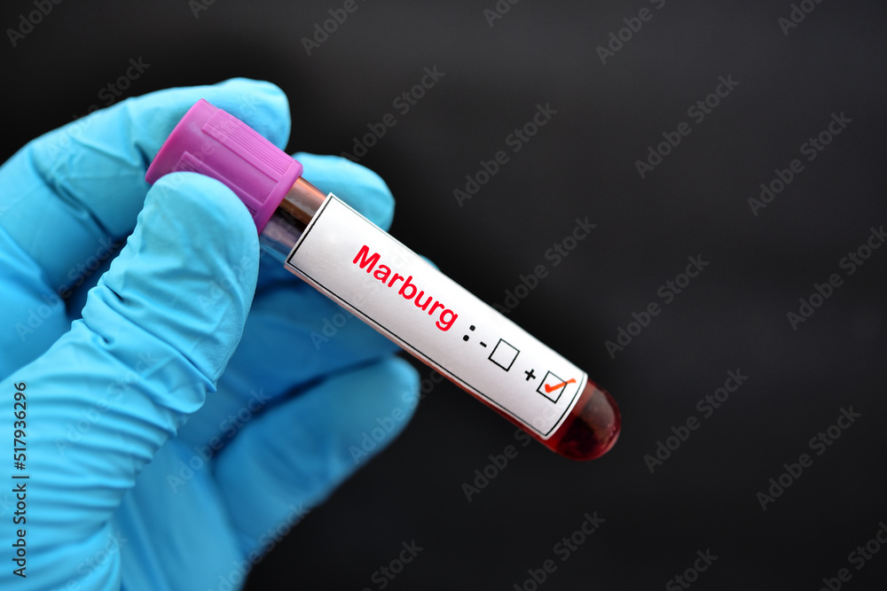 Fototapeta premium Blood sample tube positive with Marburg virus