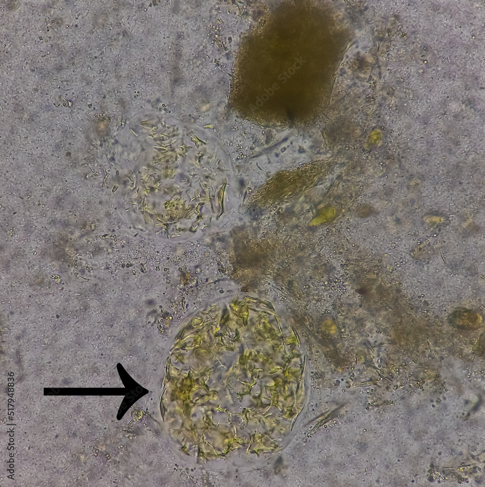 Vegetable cell of stool analysis under 40x light microscope, fecul