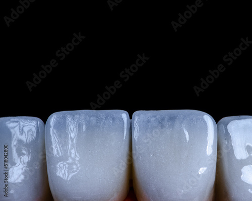 Canvas Print laboratory prepared zirconium teeth
