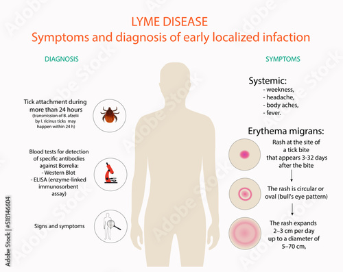 Symptoms and diagnosis of Lyme disease, vector, illustration