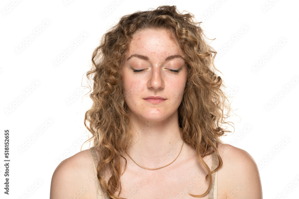 Young blond women with long curly hair and problematic skin. Eyes closed