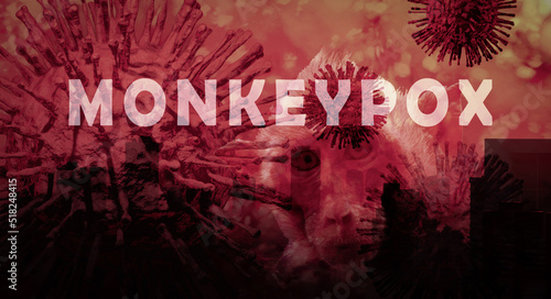 Monkeypox outbreak concept. Monkeypox is caused by monkeypox virus. Monkeypox is a viral zoonotic disease. Virus transmitted to humans from animals. Monkeys may harbor the virus and infect people. photo
