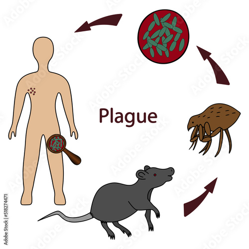 Bubonic plague. Plague bacterium infection scheme: rat-flea-human. Color vector illustration. The path of infection with a dangerous disease. Isolated background. Science and medicine. 