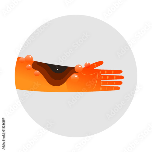 The third degree burn injury, skin burn injury.