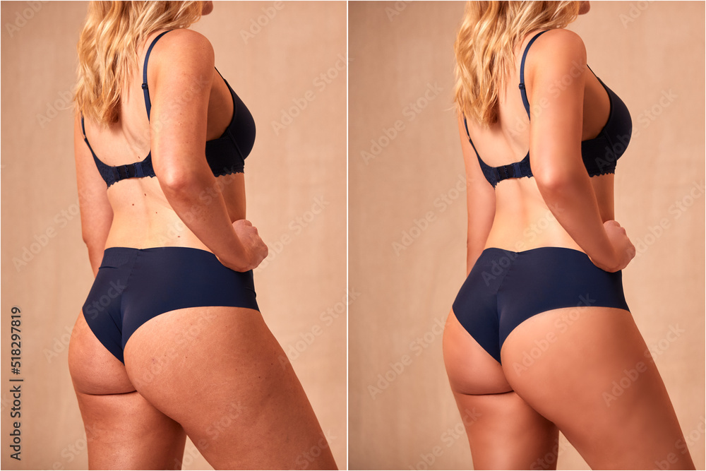 Composite Shot Showing Photo Of Woman In Underwear Before And After composite-shot-showing-photo-of-woman-in-underwear-before-and-after