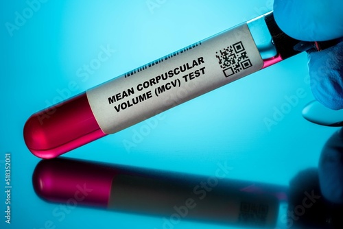 Mean Corpuscular Volume (Mcv) Test Blood Tests for Older Adults. Recommended Blood Test for the Elderly. photo