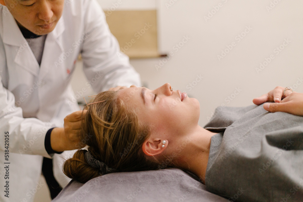 Acupuncture
Acupuncture