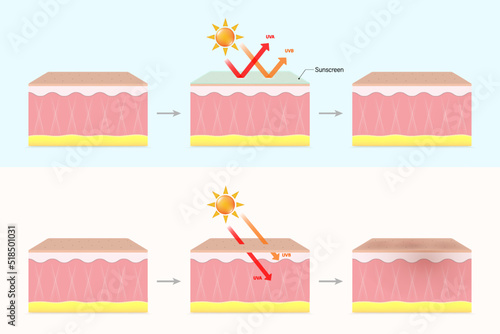 The difference between sunscreen and non-sunscreen skin. Protects skin from UVA and UVB rays.