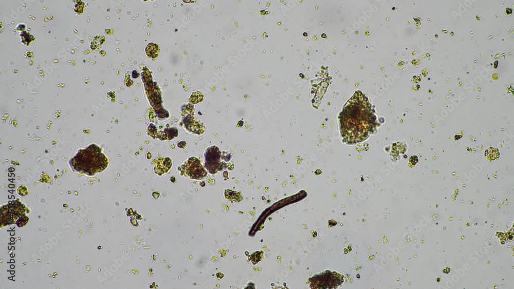 soil microbes organisms in a soil and compost sample, fungus and fungi ...
