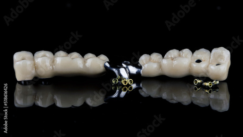 two dental prosthesis bridges made of zircon and a titanium bar with orthopedic screws on black glass with reflection