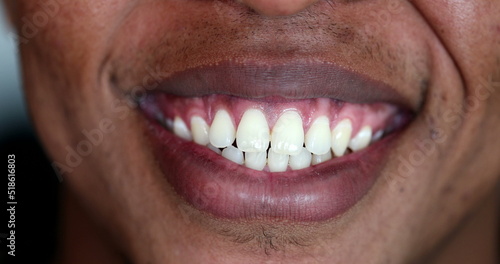 African person mouth smiling close-up, white teeth