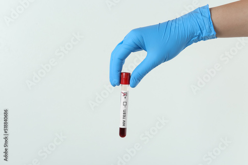 Scientist holding tube with blood sample and label HIV Test on light background, closeup