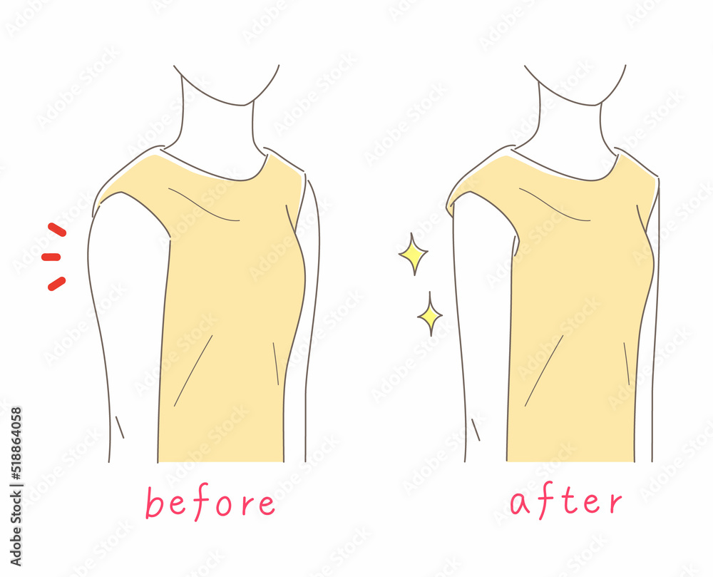二の腕が細い女性と太い女性のイラスト素材 Stock ベクター | Adobe Stock