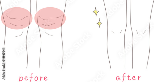 足が太い女性と細い女性のイラスト素材