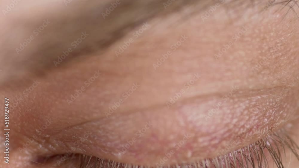 Closeup of blue male eye with contact lens looking at camera. Selective focus. Closeup of blue male eye with contact lens looking at camera. Selective focus.