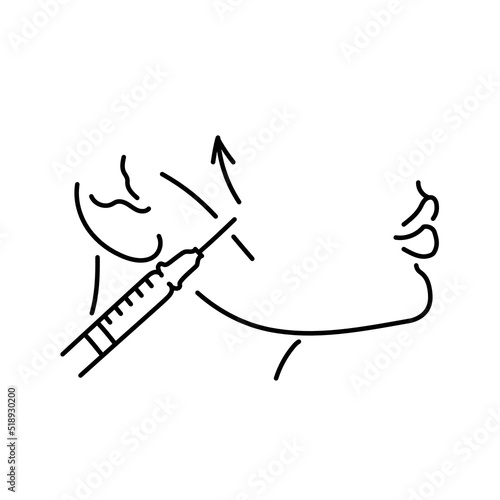 Fine cheekbone correction color line illustration. Hyaluronic injection.