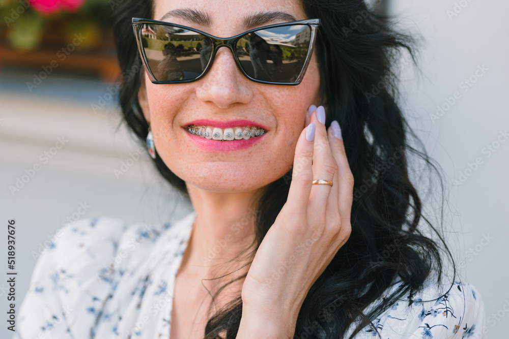 Naklejka premium Close up portrait of cheerful woman with braces in the city. Attractive woman wearing dental braces.