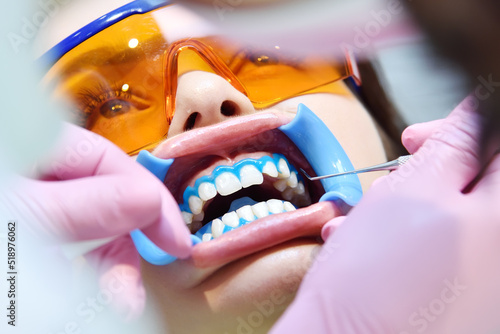 Photography Woman patient with retractor