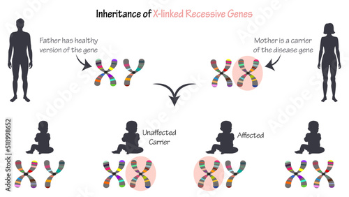 Inheritance of X-linked Recessive Genes vector diagram