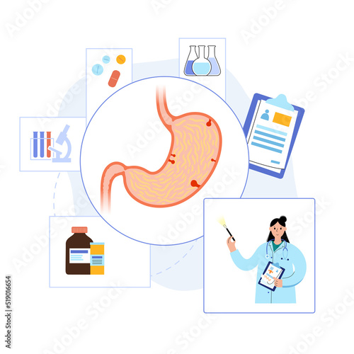 Stomach polyp removal