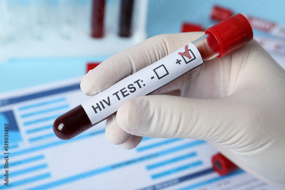 Fototapeta premium Scientist holding tube with blood sample and label HIV Test near laboratory form, closeup