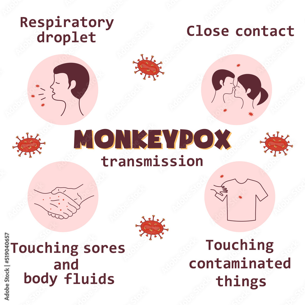 Monkeypox virus transmission infographics icons. Flat vector illustration for informing people about an infectious disease. Monkeypox virus transmission infographics icons. Flat vector illustration for informing people about an infectious disease.