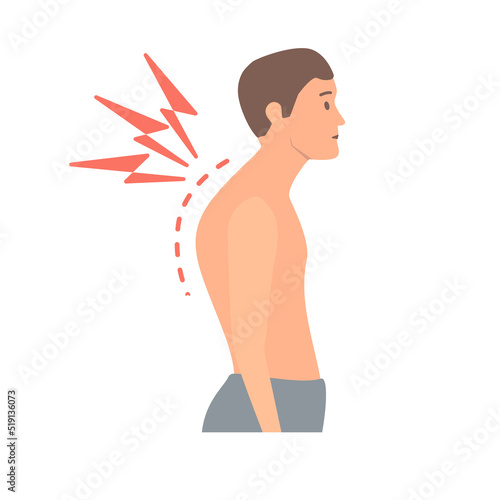Back ache and poor stance. Man with bad posture. Spine curvature due to scoliosis. Body imbalance defect concept. Medical vector illustration.