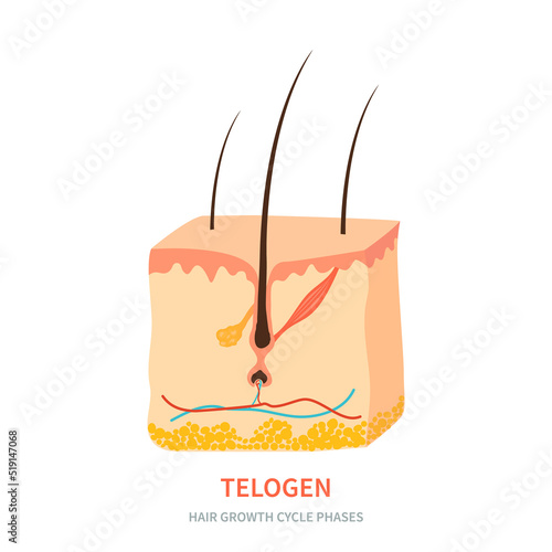 Hair follicle in telogen phase shown in skin cross-section. Hair growth cycle medical educational poster. Removal, treatment and transplantation concept. Vector illustration. photo