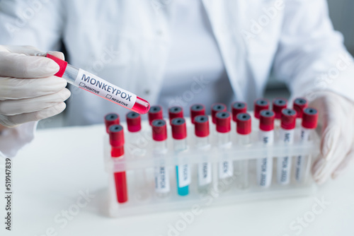 Cropped view of blurred scientist holding test tube with monkeypox lettering in lab. photo