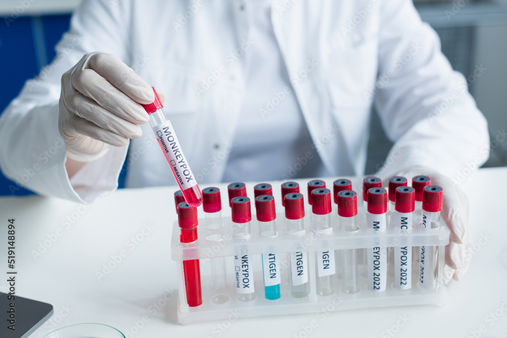 Cropped view of scientist holding test tube with monkeypox lettering in laboratory. Cropped view of scientist holding test tube with monkeypox lettering in laboratory.