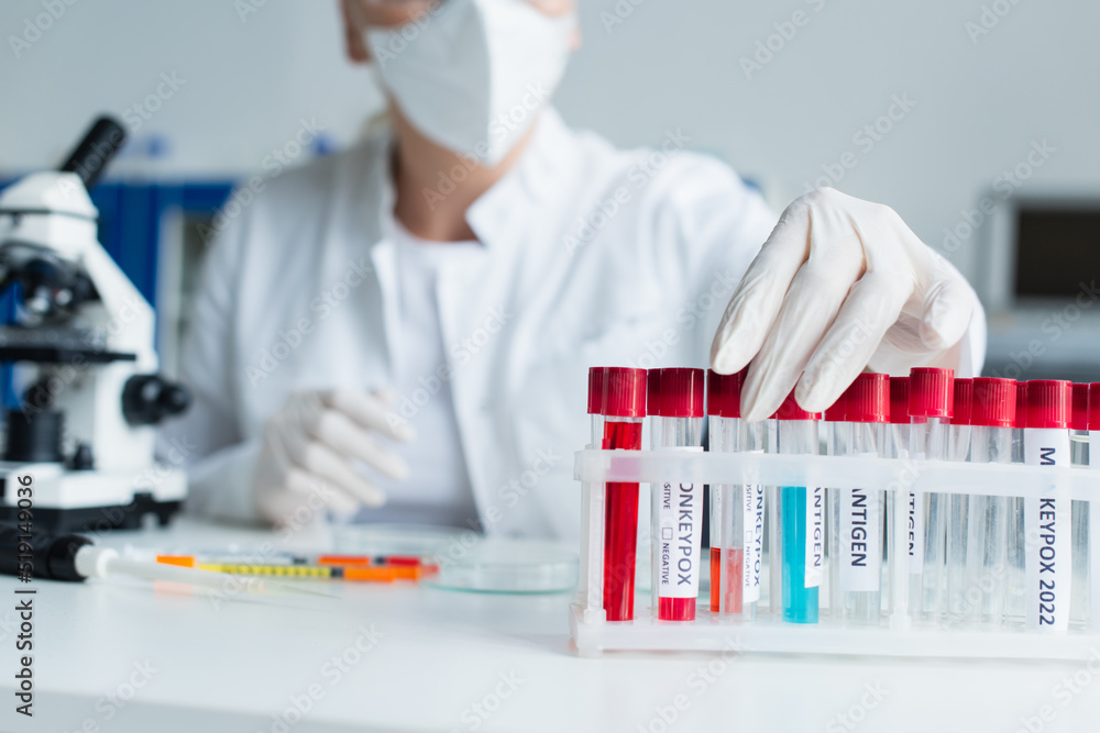 Cropped view of blurred scientist taking test tube with monkeypox lettering in lab. Cropped view of blurred scientist taking test tube with monkeypox lettering in lab.