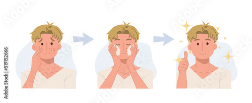 skin care concept. acne treatment before and after, facial cleansing foam, men's skin care,flat vector cartoon illustration