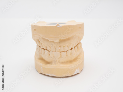 Plaster model or cast of human teeth.