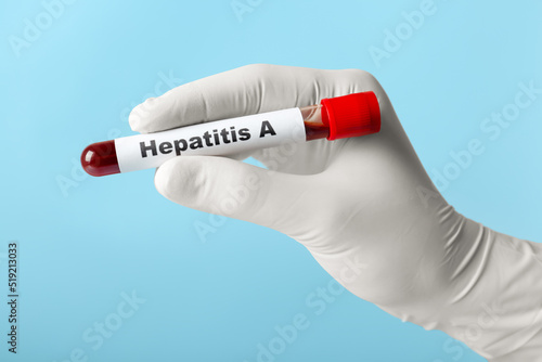 Scientist holding tube with blood sample and label Hepatitis A on light blue background, closeup