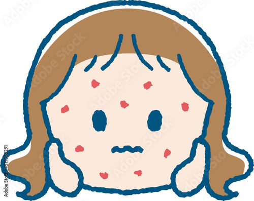 湿疹が出た女の子のイラスト