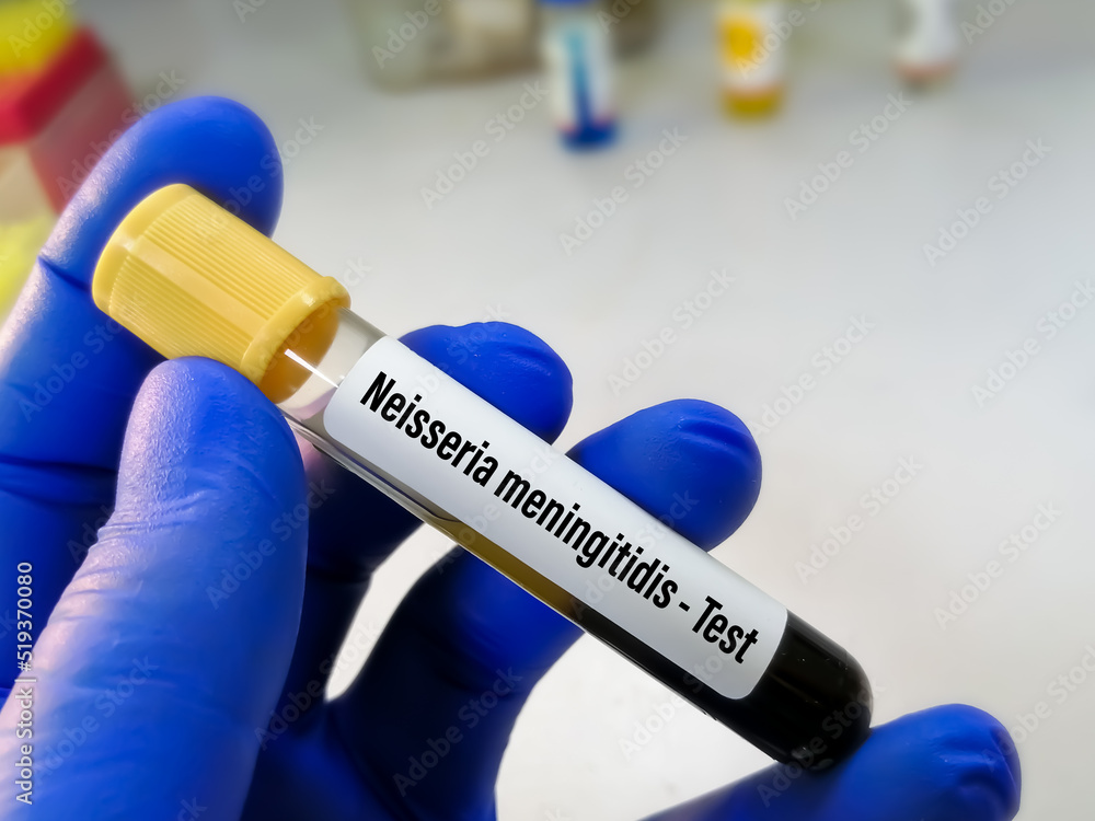 Blood sample for Meningococcal disease test, this disease caused by