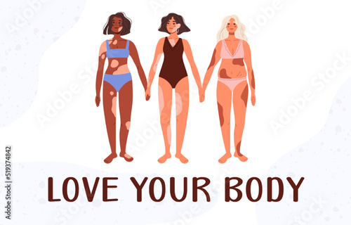 Multinational womens with skin problems in swimsuit. Self love. Skin disease. Body positive, pigmentation disease. Inscription Love your body Flat vector illustration