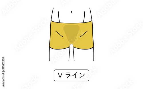 メンズ脱毛、Vライン、下着着用