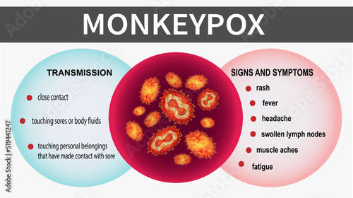 Monkeypox virus cells. Awareness of the transmission, signs and symptoms of monkeypox. Monkeypox concept. Virus epidemic outbreak. Health care in USA, Europe and Asia. Vector EPS10 Illustration