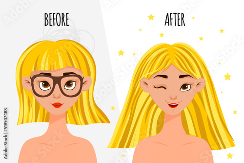 Female character "before" and "after" cosmetic procedure. Cartoon style. Vector illustration.