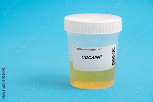 Cocaine. Cocaine toxicology screen urine tests for doping and drugs